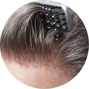 MEN TOUPEE